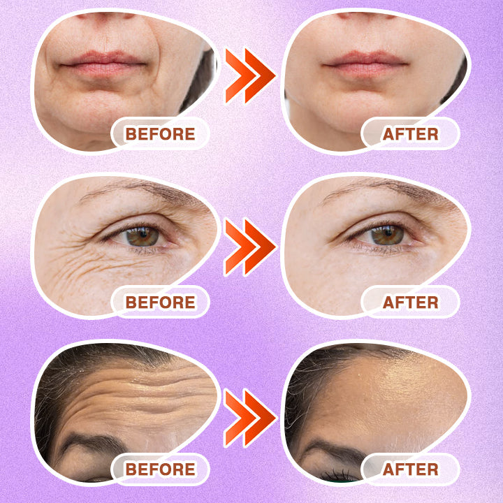 3-in-1 Microneedle Anti-Aging Patch